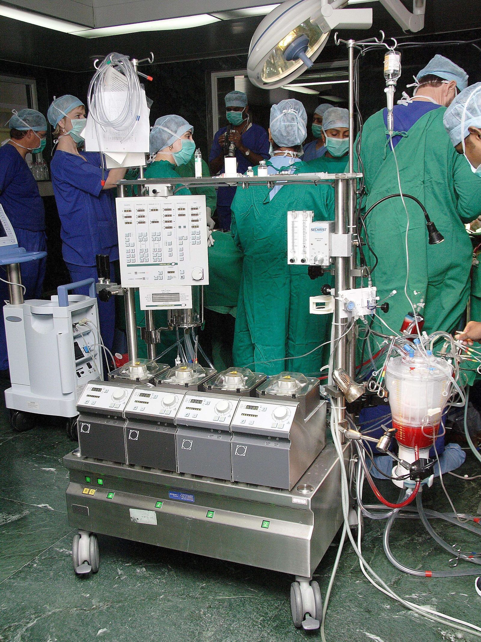No open-heart surgery, no perfusion course, say experts